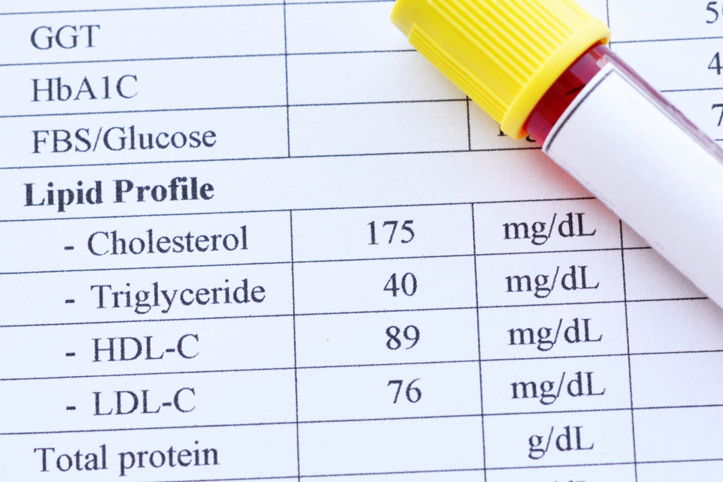 What Is A Good Lipid Panel